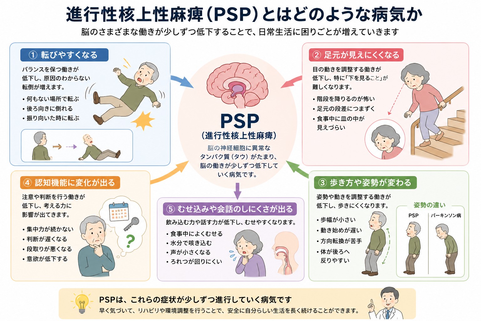 進行性核上性麻痺（PSP）の5つの代表的な症状（転びやすくなる、足元が見えにくくなる、歩き方や姿勢が変わる、認知機能に変化が出る、むせ込みや会話のしにくさが出る）を示す図解